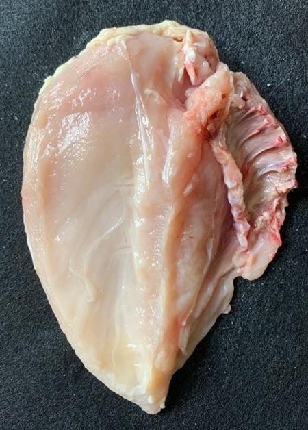 Figure 5. Split breast